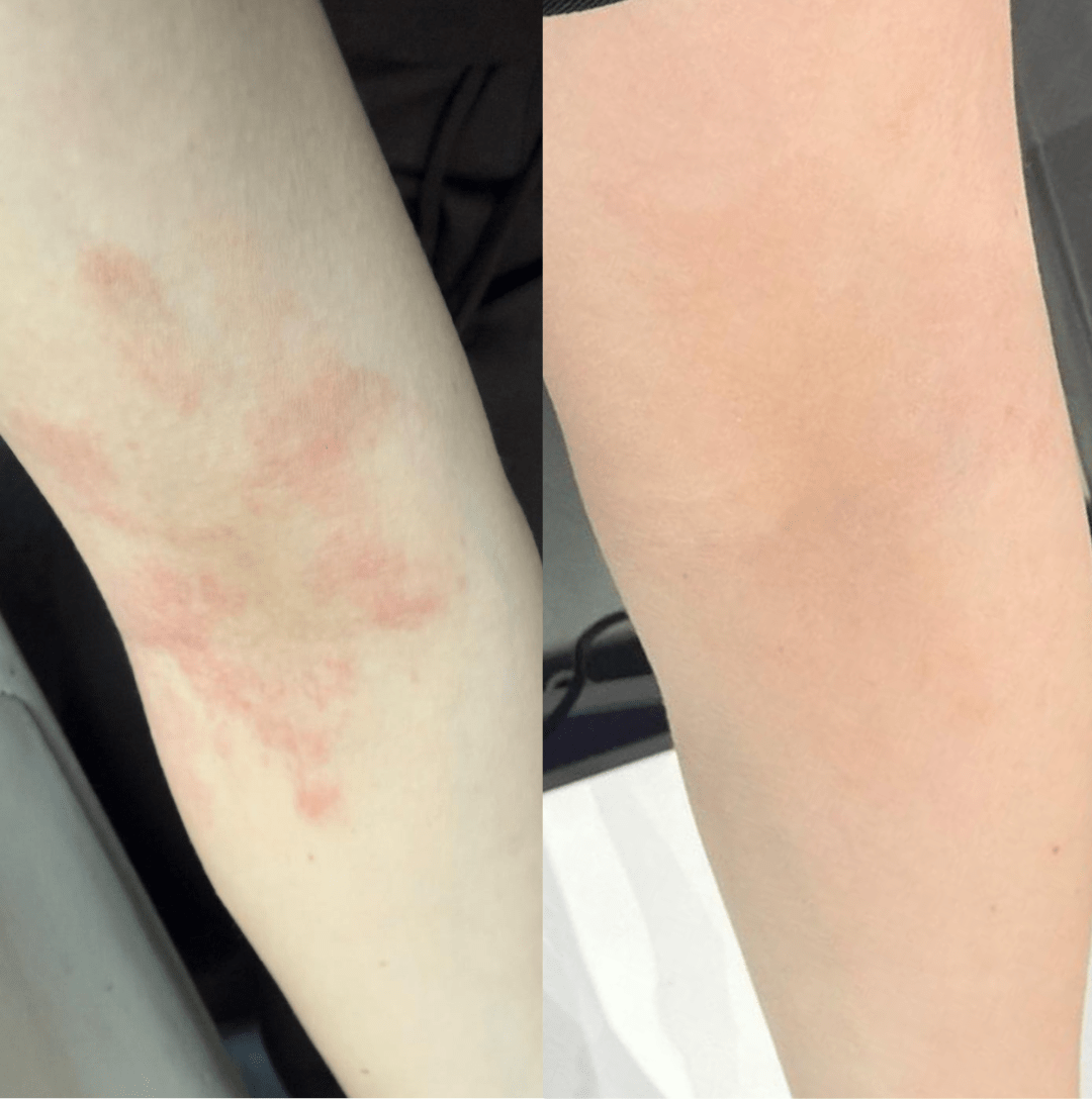 Derma Soothe Balm skincare